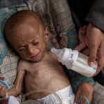 Katilin İsrail'in yardım girişini önlediği Gazze'de 3 bin 500 çocuk açlıktan ölebilir