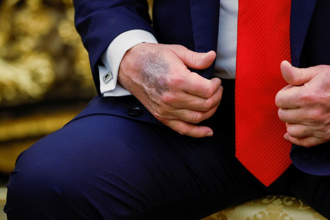 Sosyal medyanın konuştuğu ifadesi! Dünya Trump hakkında konuşuyor: ortada hayır ... eldeki çürük dikkat çekti 2