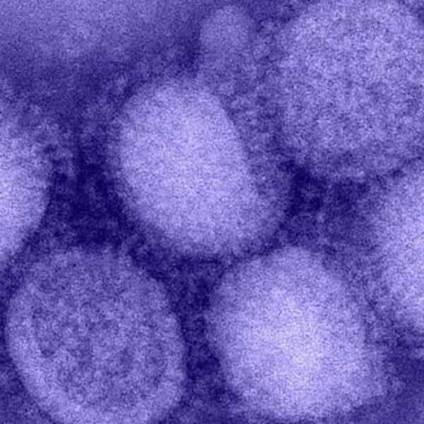 Kuzey Yarımküre'de “H3N2” alarmı! “Eşi görülmemiş grip vakaları yaşanıyor”