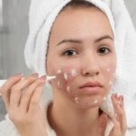 Cilt Sorunlarının Gizli Tetikleyicileri: Sivilceye Neden Olan 10 Alışkanlık – Son Dakika Hayat Haberleri